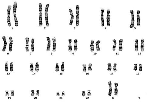 Image result for karyotype