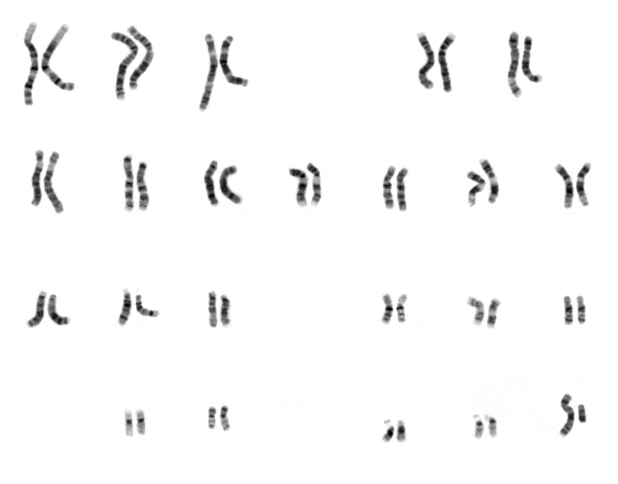 Image result for normal male karyotype